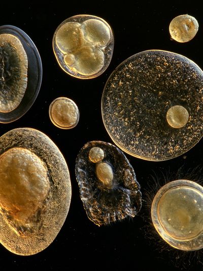 Golden Cell Forms Abstract Poster.