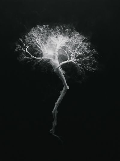 Ghost Tree Black-White Print. poster