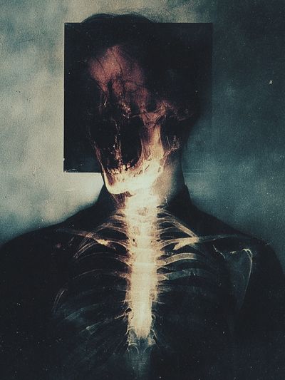 X-Ray Figure Surrealism Poster. poster print