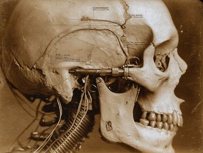 Cybernetic Skull Sepia Print.
