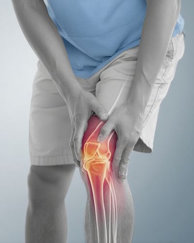 Knee Pain Anatomy Photography Poster. poster print