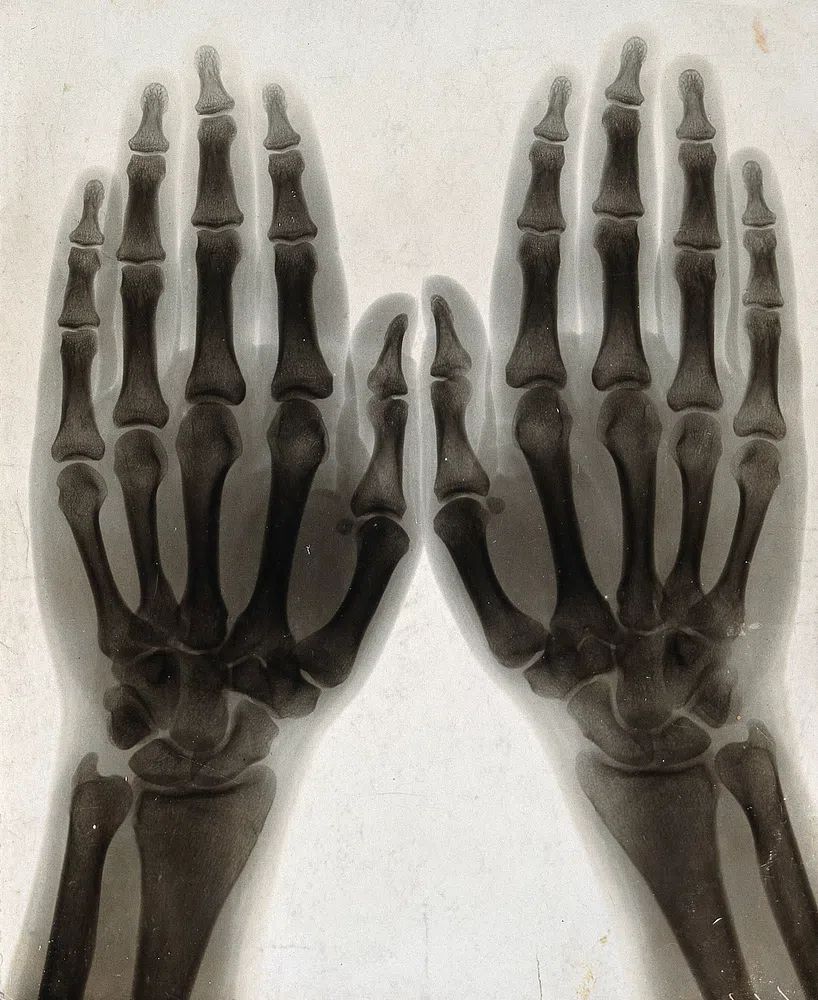 X-Ray Hands Black-White Poster. poster — photography art