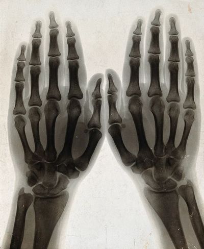 X-Ray Hands Black-White Poster. poster print