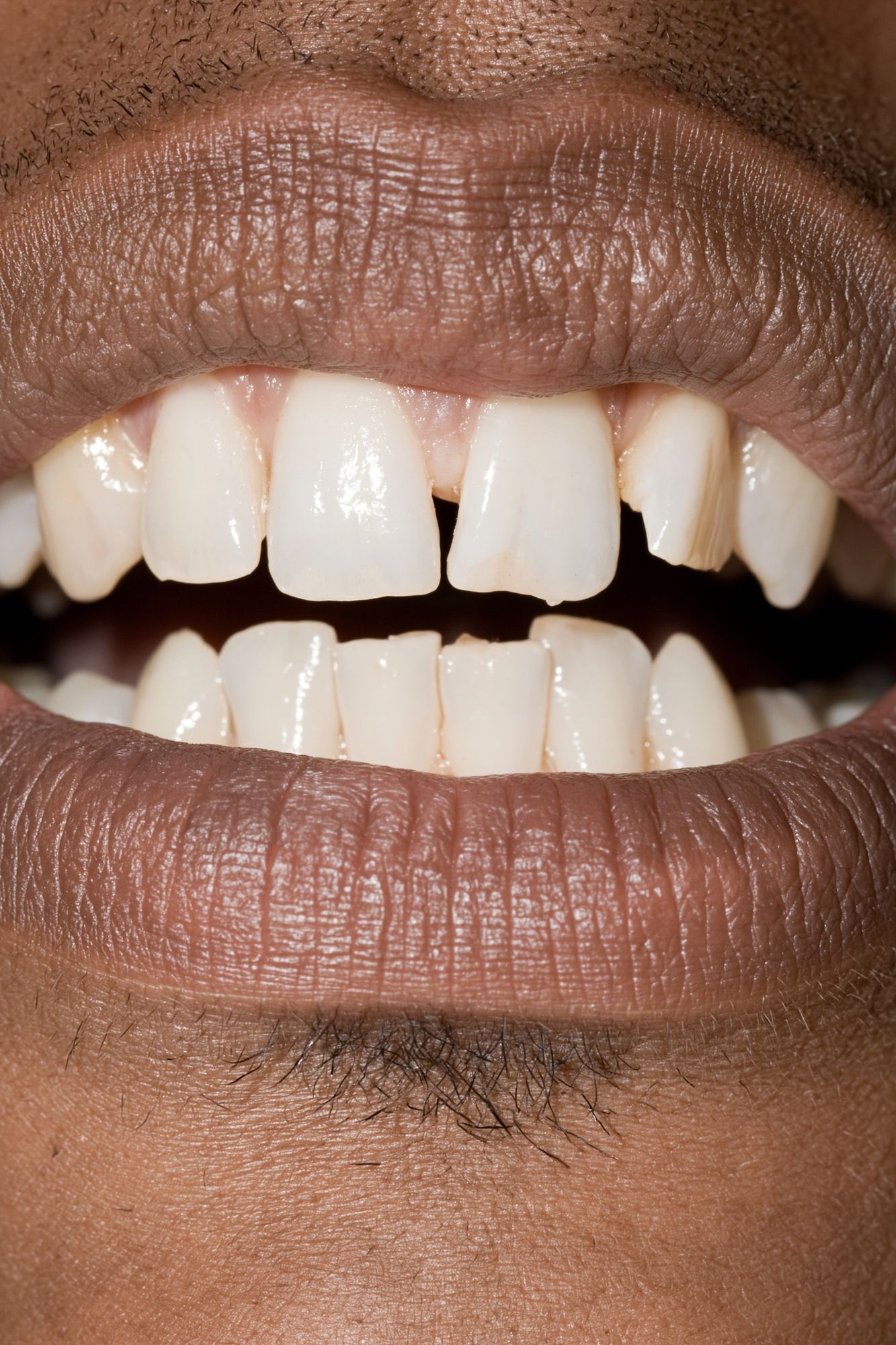 Close-Up Smile Photography Poster. poster detail