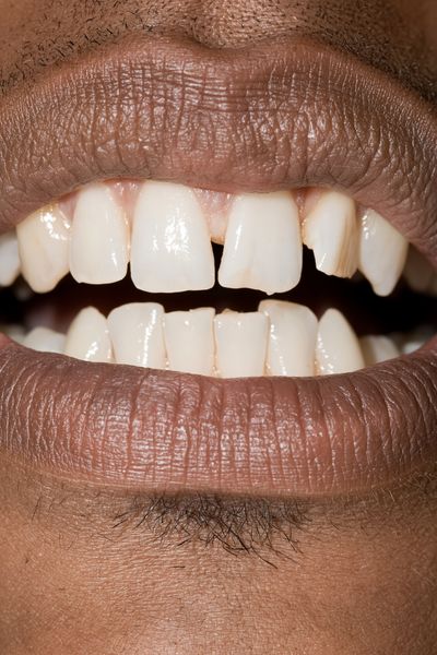 Close-Up Smile Photography Poster.