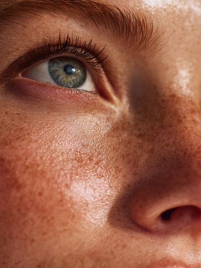 Freckled Face Close-Up Photography Poster.