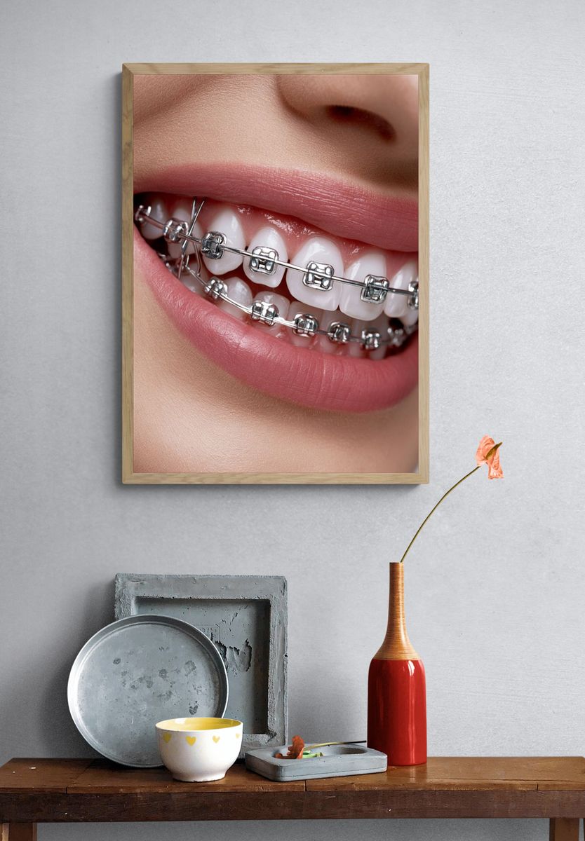 Braces Smile Photography Poster. — room view 3