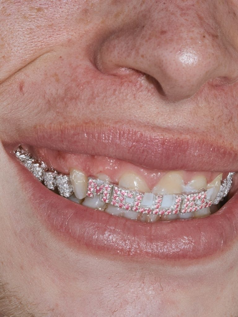 Diamond Grill Smile Photography Poster. poster — photography art