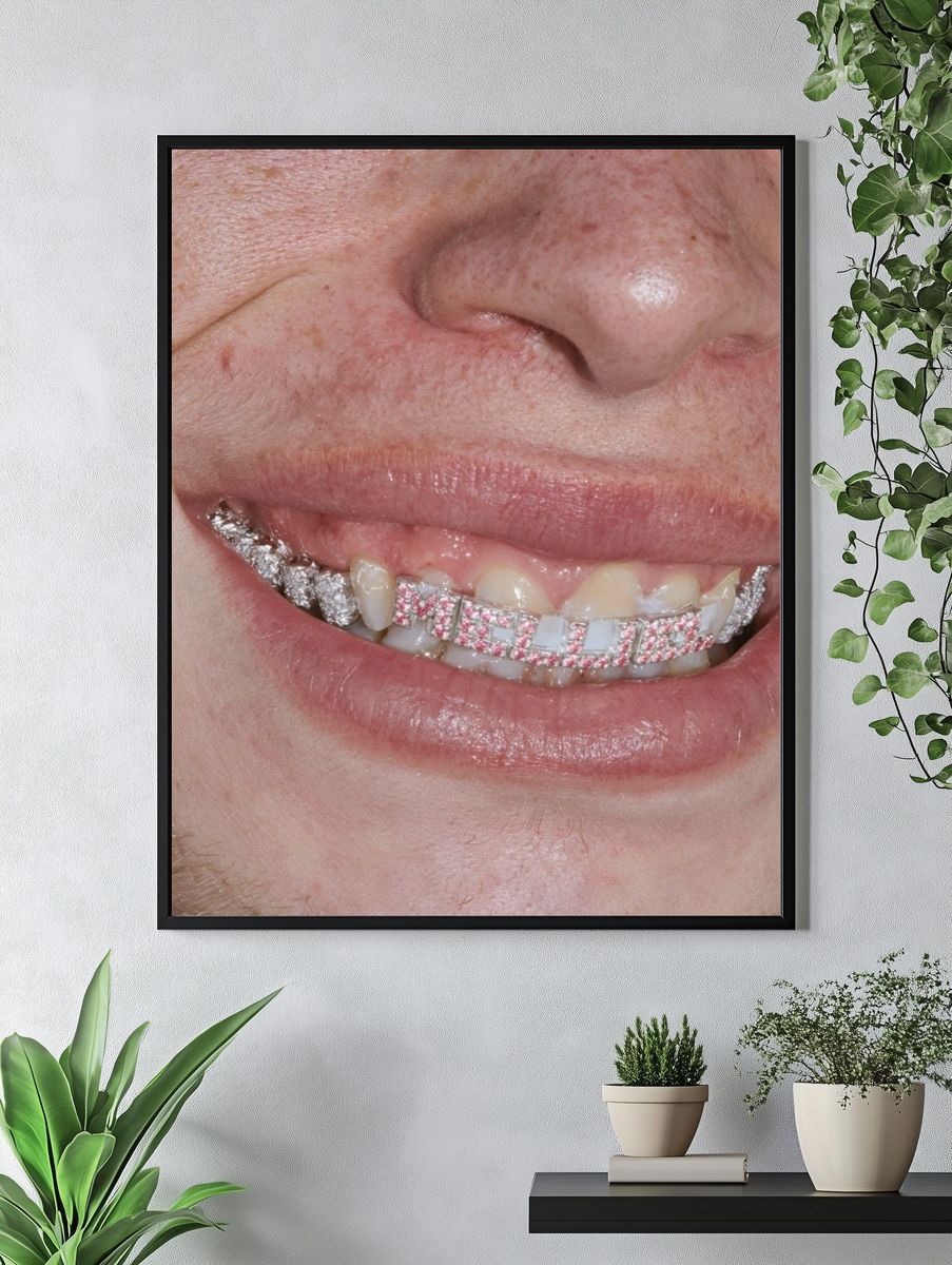 Diamond Grill Smile Photography Poster. — room view 4