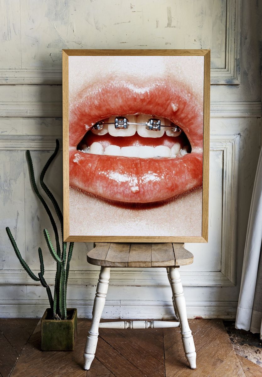 Braces Lips Close-Up Photography Poster. — room view 1