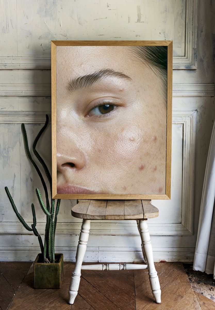 Freckled Face Portrait Print. — room view 1