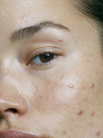 Freckled Face Portrait Print. poster